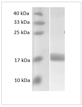 Human MCP2 protein, SUMO tag