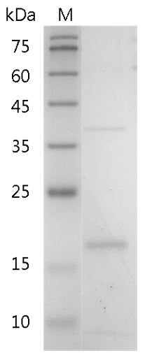 Mouse IL-19 Protein, His tag (Animal-Free)