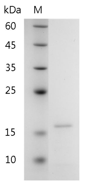 Human Galectin-10 Protein, His tag (Animal-Free)