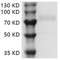 Human CD19 protein, Fc tag (Animal-Free)