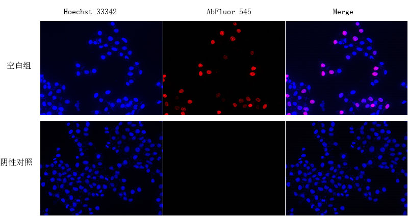 EdU Cell Proliferation Image Kit (Orange Fluorescence)