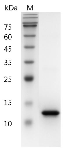 Human CD40L Protein, His tag (Animal-Free)