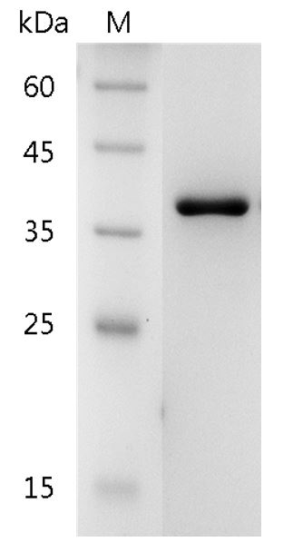 Human Galectin-8 Protein, His tag (Animal-Free)