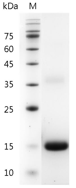 Human IL-31 Protein, His tag (Animal-Free)