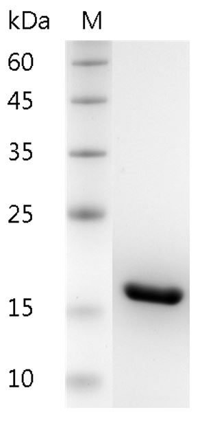 Human IL-1β protein