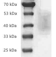 Human CD226/DNAM-1 protein, His tag (Animal-Free)