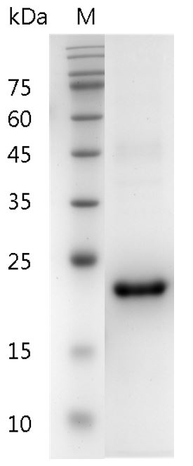 Human IL-29 Protein, His tag (Animal-Free)