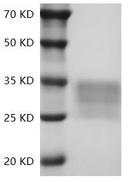 Human CD7/GP40 protein, His tag (Animal-Free)