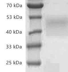 Human CD84/SLAMF5 protein, His tag (Animal-Free)