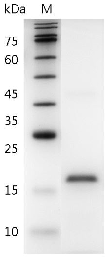 Human IL-19 Protein, His tag (Animal-Free)