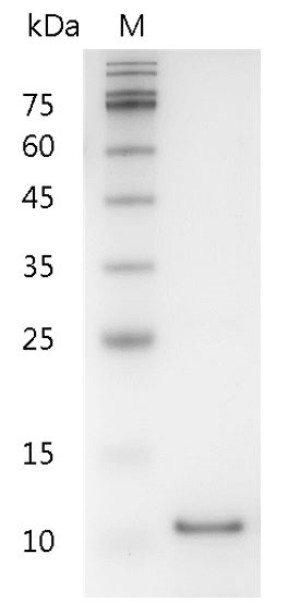 Human IL-5 Protein, His tag (Animal-Free)