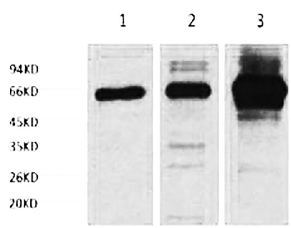 NFkB p65 Monoclonal Antibody