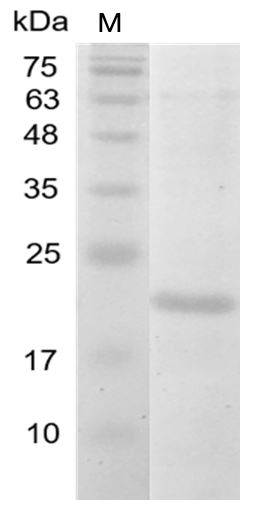 Human IL-38 Protein, His tag (Animal-Free)