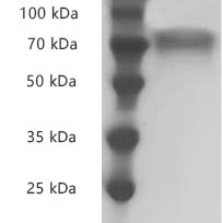 Human CD30/TNFRSF8 protein, His tag (Animal-Free)