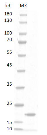 Rat GM-CSF protein,His tag