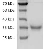 Recombinant SARS-CoV-2 Spike RBD Protein, His tag (Animal-Free)