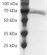 Human CD73/NT5E protein, His tag (Animal-Free)