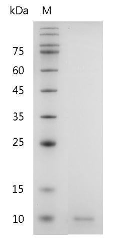 Human CXCL5 Protein, His tag (Animal-Free)