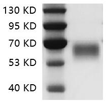 Human CD28 protein, Fc tag (Animal-Free)