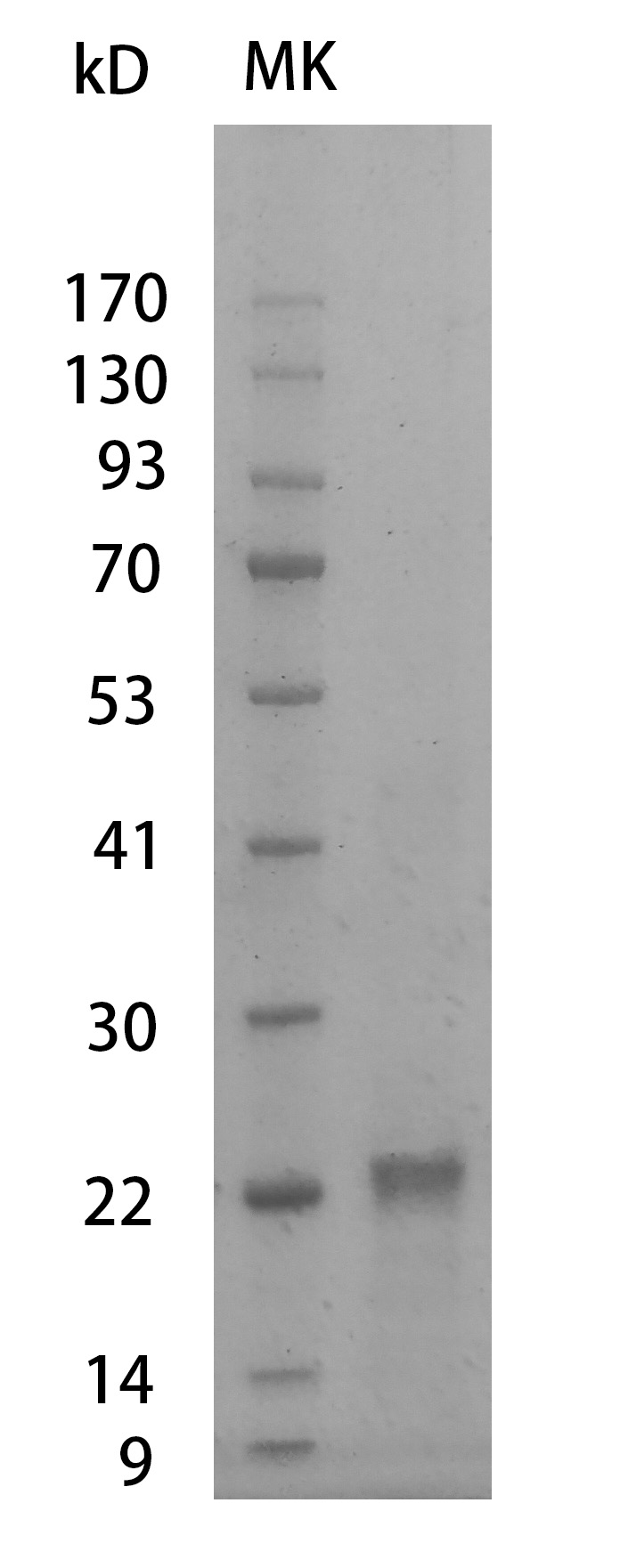 Mouse VEGF165 Protein, His tag