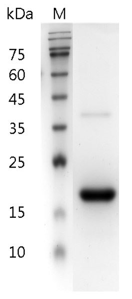Human IFN-β1a protein