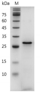 Human Galectin-3 Protein, His tag (Animal-Free)