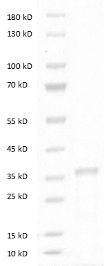 Human DKK-1 Protein
