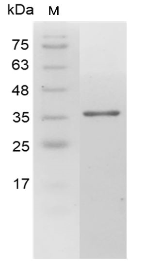 Human Galectin-4 Protein, His tag (Animal-Free)