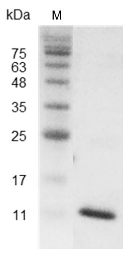 Human CXCL13 Protein, His tag (Animal-Free)
