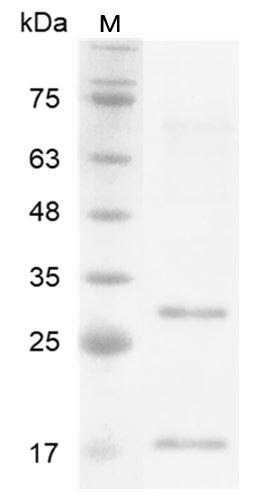 Human IL-17D Protein, His tag (Animal-Free)