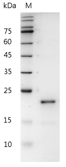 Human IL-28B Protein, His tag (Animal-Free)