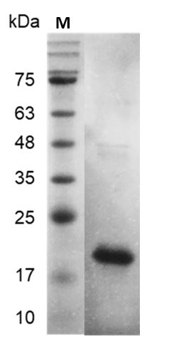 Human FGF1/aFGF Protein, His tag (Animal-Free)