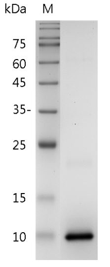 Human CXCL4 Protein, His tag (Animal-Free)