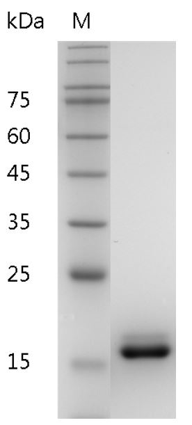 Human IL-36RA Protein, His tag (Animal-Free)