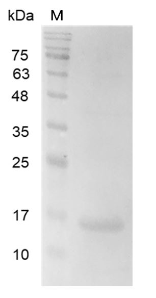 Human Galectin-2 Protein, His tag (Animal-Free)