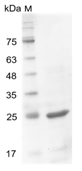 Human IL-27 EBI3 Protein, His tag (Animal-Free)