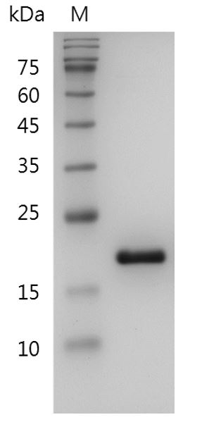 Human IL-1RA Protein, His tag (Animal-Free)