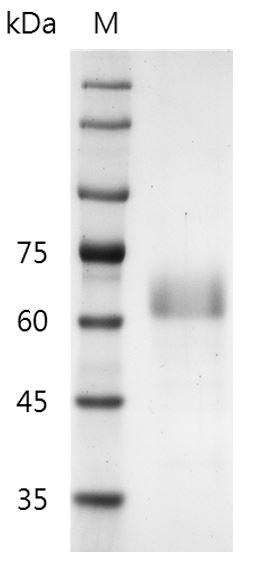 Human RSPO1/R-spondin 1 Protein, His-SUMO tag (Animal-Free)