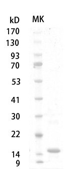 Human/Mouse/Rat TGF-β1 protein, His tag