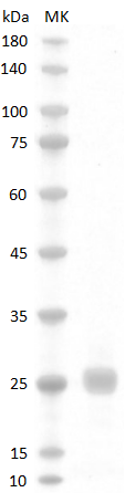 Mouse VEGF164 Protein, His tag